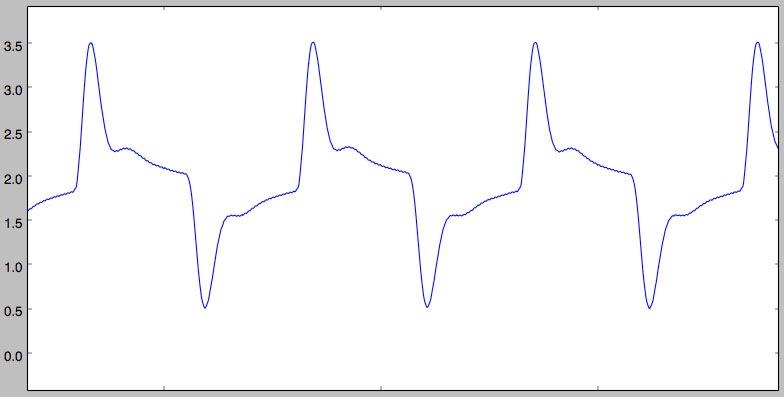 filtered signal 20MS